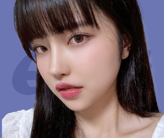 절개 티안나♥미니리프팅