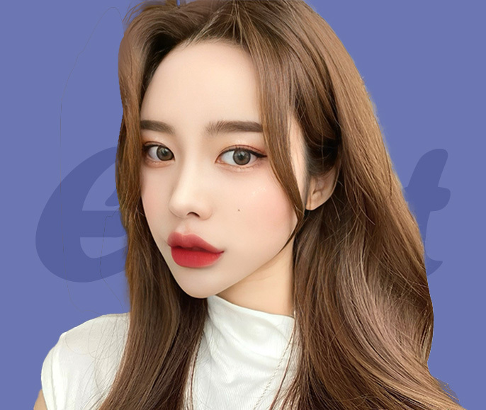 ★나나 눈재수술★