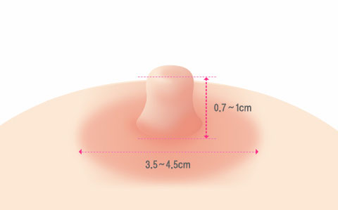 정상적인 유두