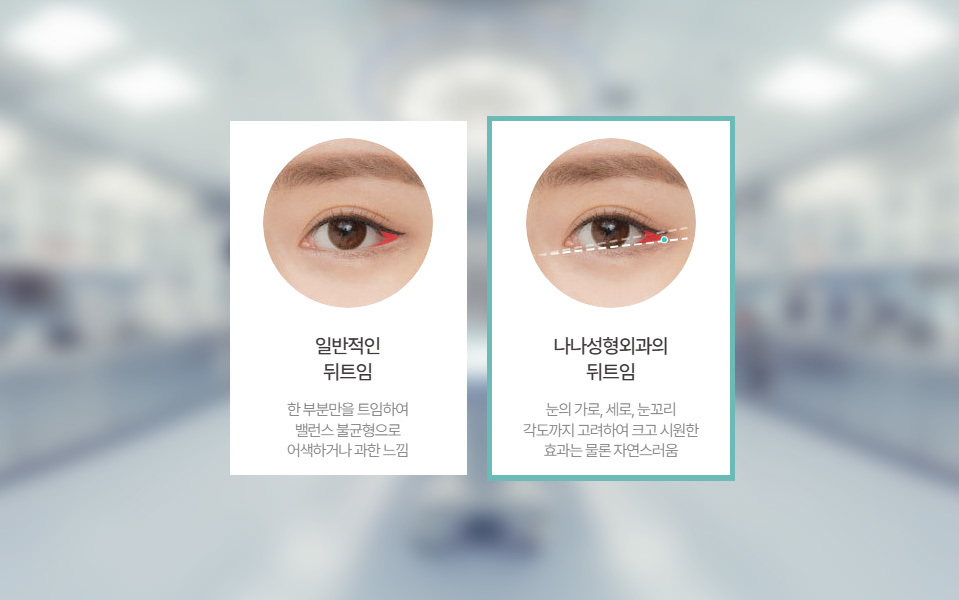나나성형외과의 뒤트임