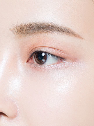 인생트임을 하면 사나워 보이는 눈꼬리를 내릴 수 있을까?