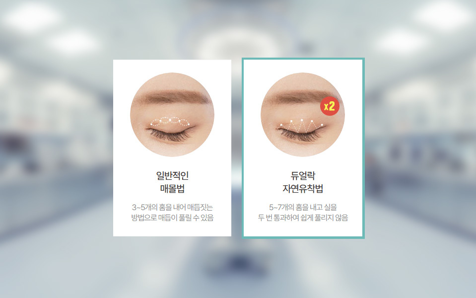 나나성형외과의 매몰법