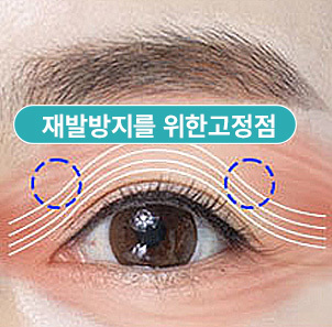 안륜근을 단단하게 고정