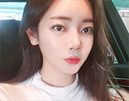 안면윤곽 before after