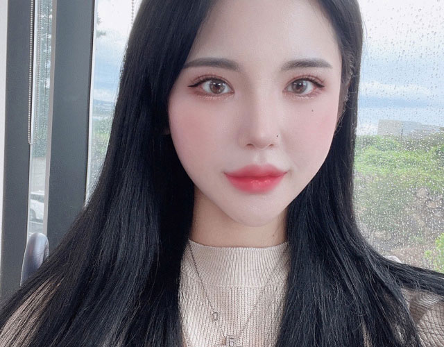 안면윤곽 after 이미지