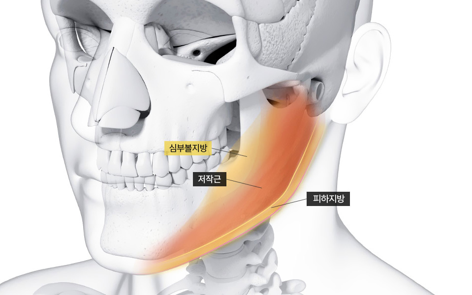 나나성형외과의 심부볼지방제거