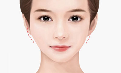 비대칭이 생긴 경우