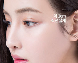 최소부위만 직선절개