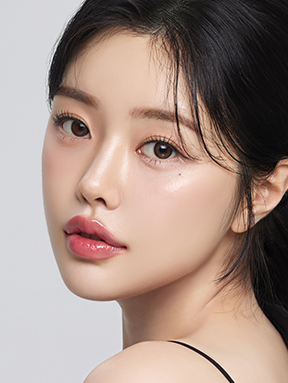 시술 즉시 리프팅 효과 확인 가능