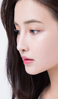 v라인