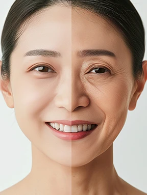 자연스러운 애교살 보존