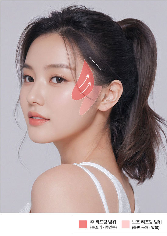 관자 부위 중심의 포니테일 리프팅 부위를 보여주는 모델