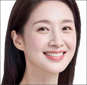 처짐과 인상 변화가 고민되기 시작하는 시기인 30대 40대 초반 눈매 턱선 변화 리프팅을 보여주는 모델