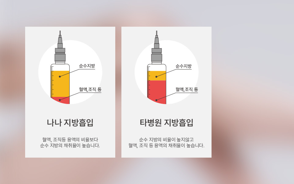 나나성형외과의 허벅지지방흡입