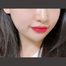 피부과 before이미지