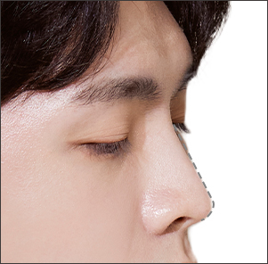 자연스럽고 곧은 남성의 코라인