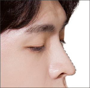 맞춤 디자인