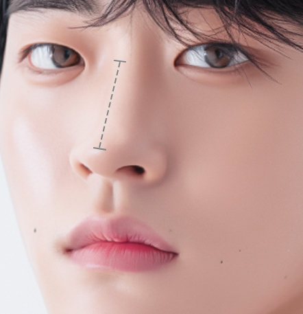 코가 낮으며 짧아 보이는 경우