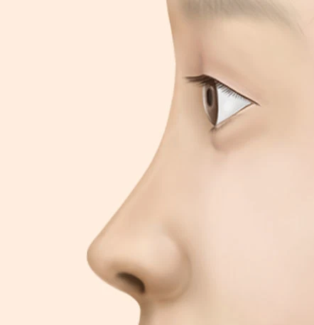 낮은 코
