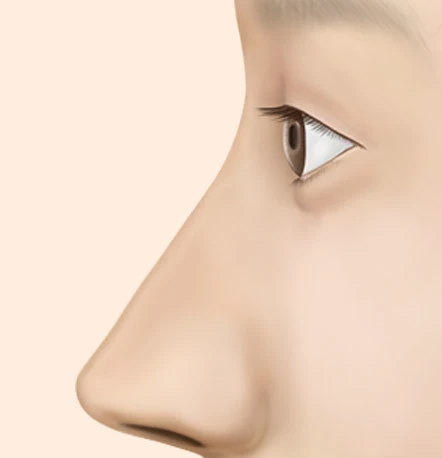 긴코