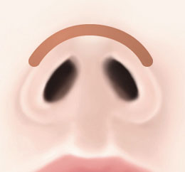 복코