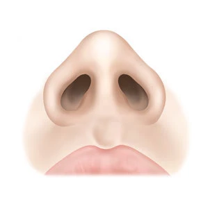 수술 후