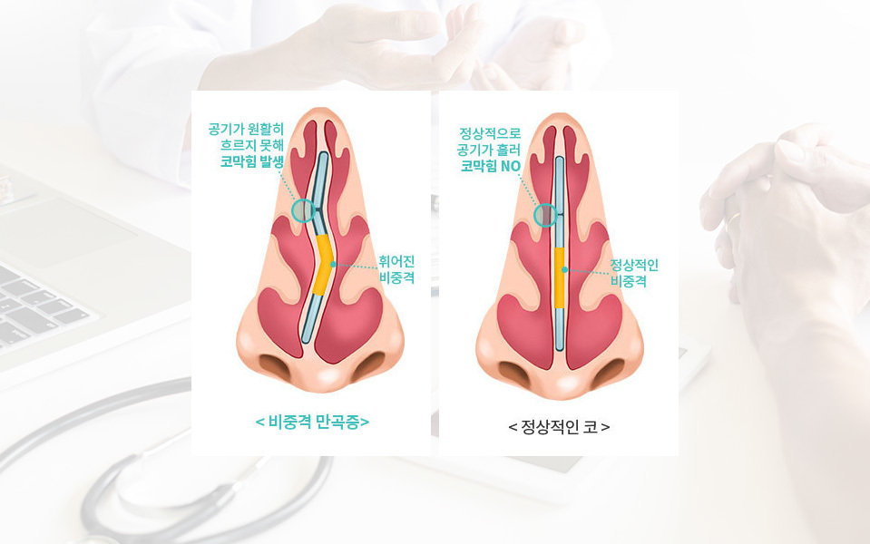 나나성형외과의 기능 코성형