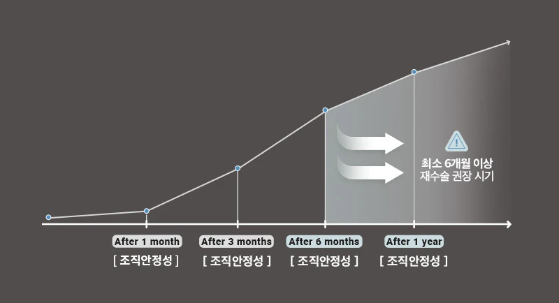 나나성형외과의 코재수술