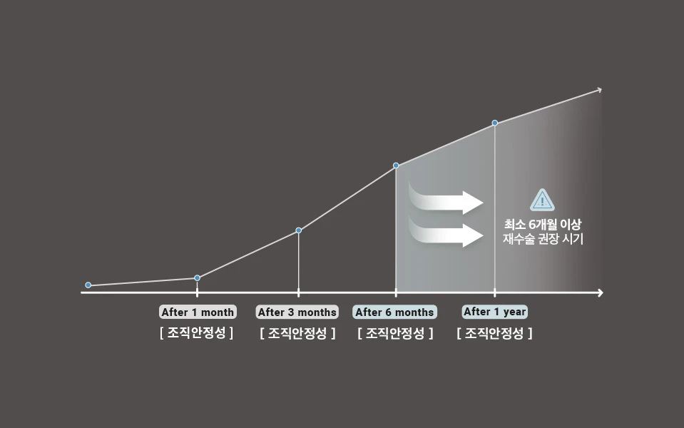 나나성형외과의 코재수술