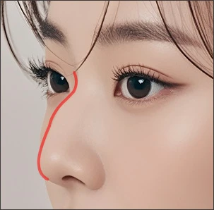 수술 전 전문의와 상담