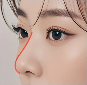 보형물 이용