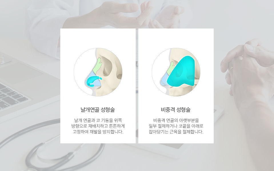나나성형외과의 화살코·긴코 성형