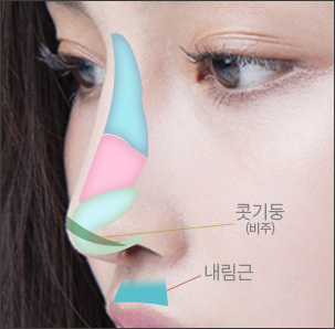 비중격연장술