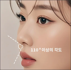 비순각이 큰 유형