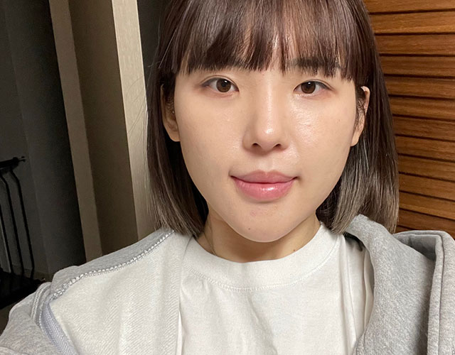 눈 before이미지