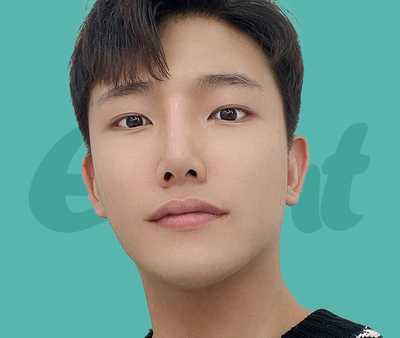 남자 코성형