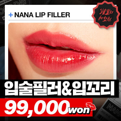 sns_입술필러 체험_A