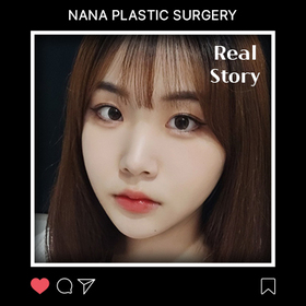 윤곽 3종 2개월 차