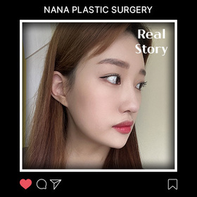 윤곽3종 3개월 차