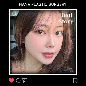 윤곽3종 3개월 후